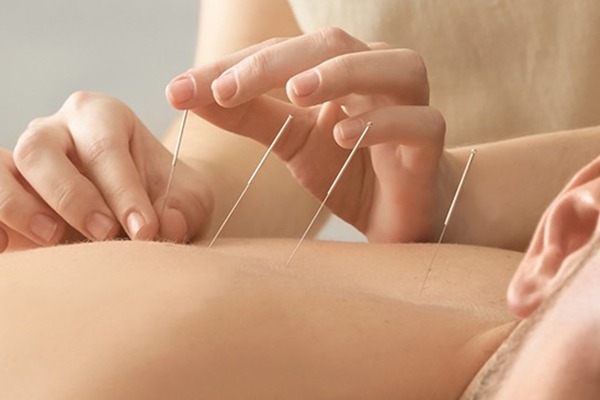 درمان پوکی استخوان با طب سوزنی