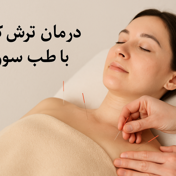 درمان ترش کردن با طب سوزنی