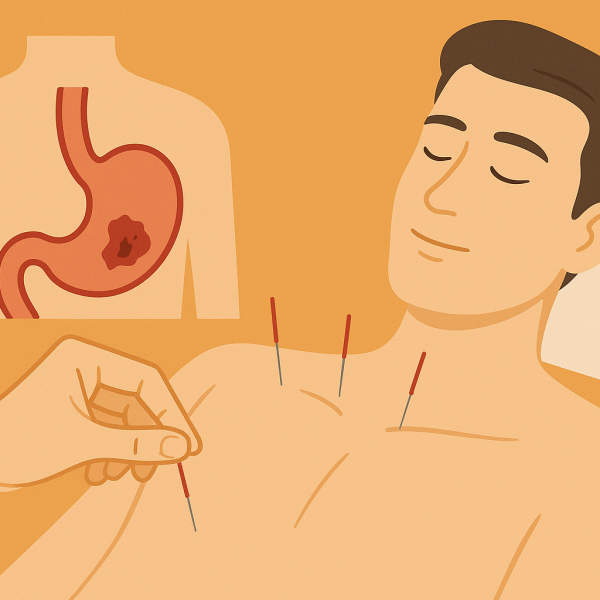 درمان زخم معده با طب سوزنی