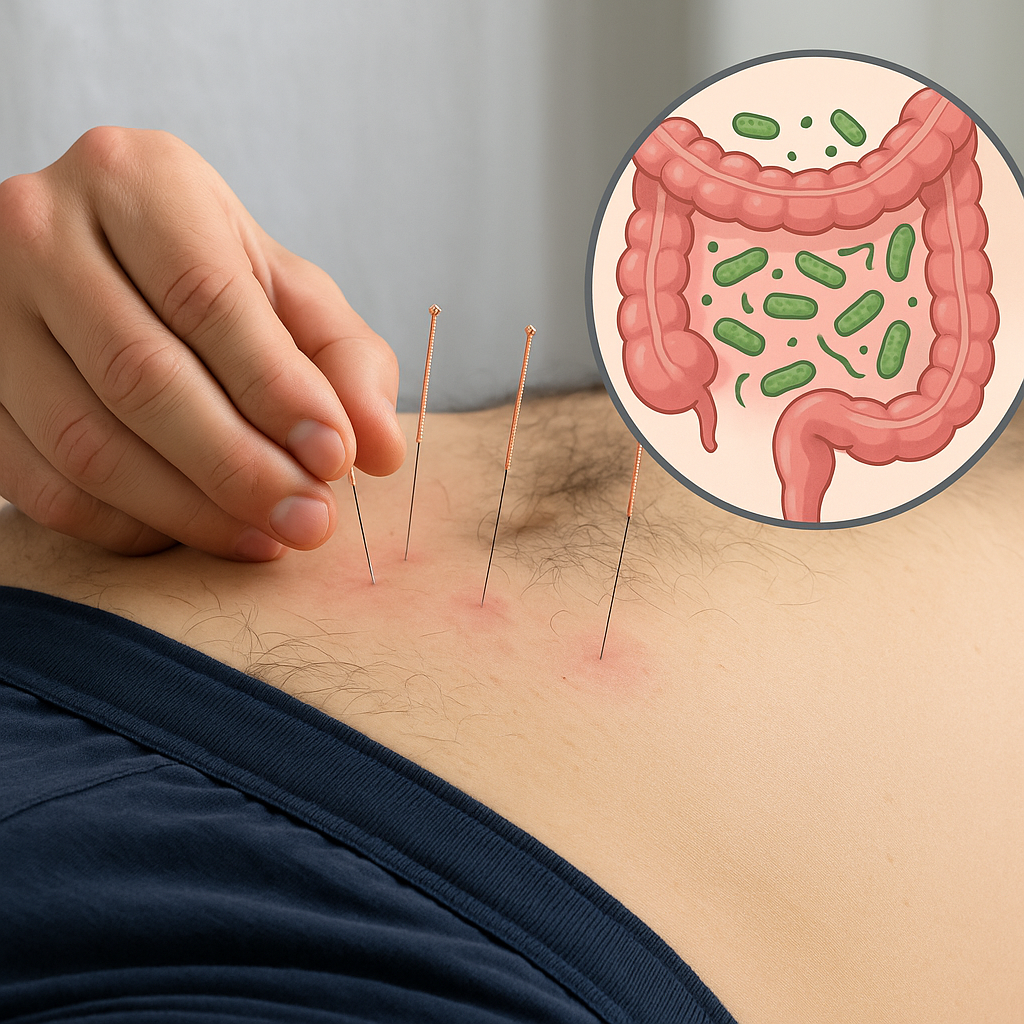 درمان عفونت باکتریایی روده با طب سوزنی