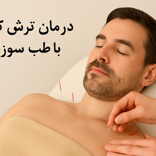 درمان نفخ روده با طب سوزنی