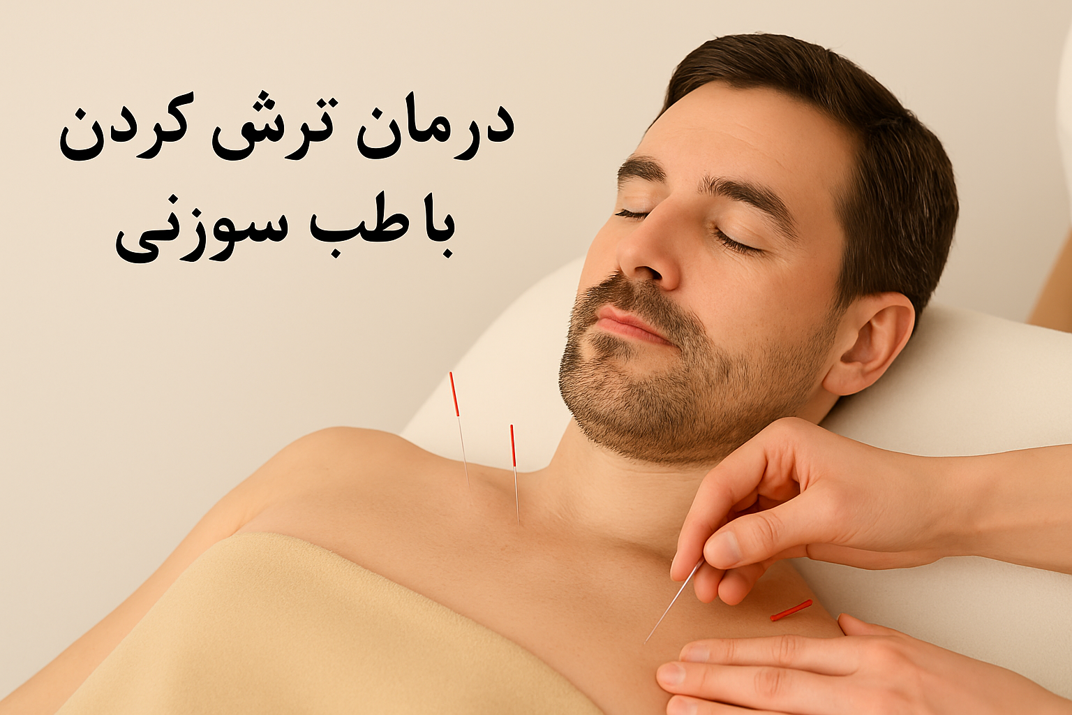 درمان نفخ روده با طب سوزنی
